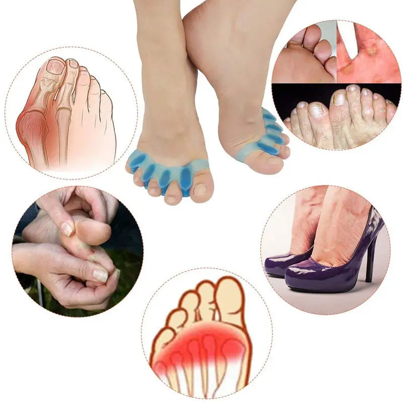 Toe Separator